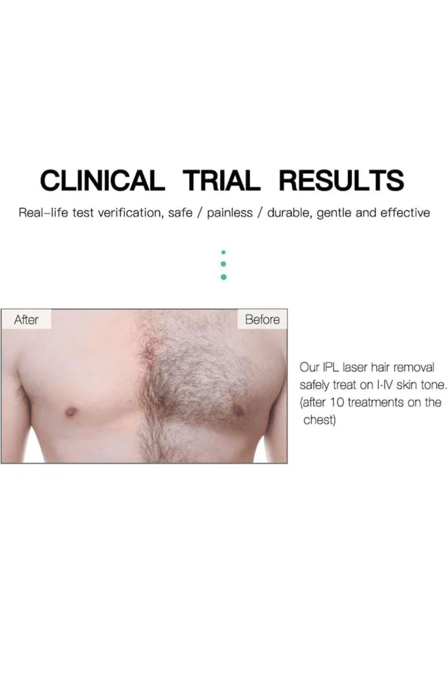Ipl Laser Hair Removal Handset
